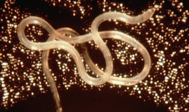 The most common intestinal parasites are hookworms, roundworms, and whipworms
